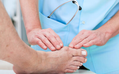 Comment se forme un hallux valgus ?