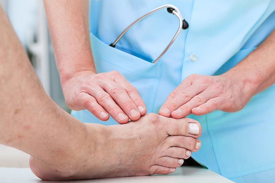 formation hallux valgus dr baudrier nicolas dr shitrit chirurgien orthopédiste et traumatologue cheville et pied paris